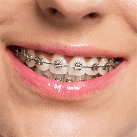 braces metal brackets|rectangular metal bracket.